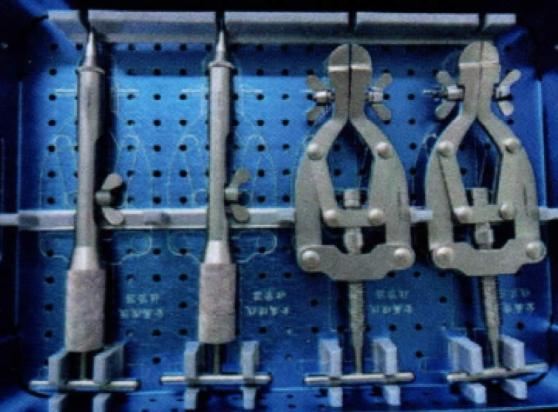 胸骨结扎固定带